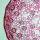 Parenchým - bunky epitelu v slučkách zdravého tkaniva pečene a pečene