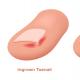 რატომ ხდება ingrown toenails გამოჩნდება?